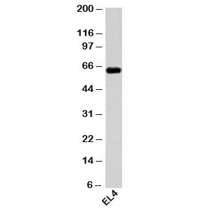 Western blot testing of mouse samples with HSP60 antibody at 1ug/ml.