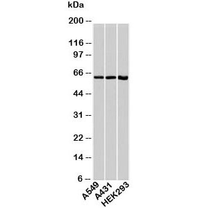 Western blot testing of human samples with HSP60 antibody at 1ug/ml.~