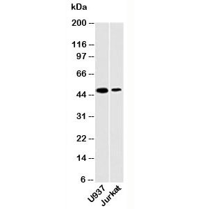 Western blot testing of human samples with DC-SIGN antibody at 2ug/ml. Predicted molecular weight ~46 kDa.