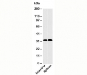 CLEC1 antibody western blot of human samples