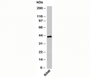 ICAD antibody western blot of mouse samples