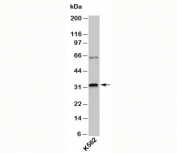 RAX antibody western blot testing of human samples