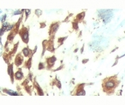ATF6 antibody testing of human breast tissue