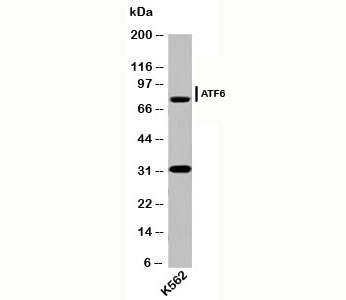 Western blot testing of human samples with ATF6 antibody (AF6229) at 2ug/ml. Predicted molecular weight: 75~90kDa.~