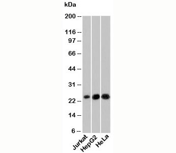 Western blot testing of human samples with NKIRAS1 antibody at 6ug/ml.