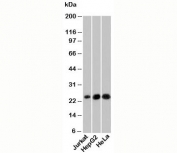 NKIRAS1 antibody western blot of human samples