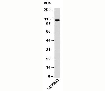 Western blot testing of human samples with Importin-9 antibody at 0.25ug/ml.~