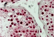 IHC testing of FFPE human testis tissue with LSD1 antibody at 5ug/ml. HIER: steam tissue sections in pH6, 10mM citrate buffer, for 10-20 min followed by cooling at RT for 20 min.