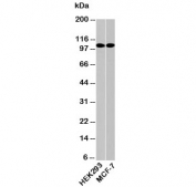 Western blot testing of human samples with LSD1 antibody at 0.5ug/ml. Expected molecular weight ~110 kDa.