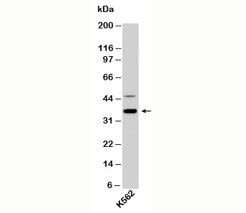 Western blot testing of human samples with NIFK antibody at 1ug/ml.