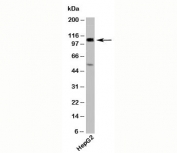 Western blot testing of human samples with CYLD antibody at 2ug/ml. Predicted molecular weight ~107kDa.