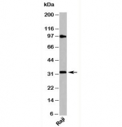 MyD88 antibody western blot of human samples. Predicted molecular weight: 33 kDa