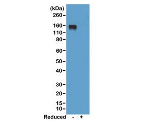 Western blot of nonreduced(-) and reduced(+) mouse IgG2a, using 0.5ug/ml of recombinant Mouse IgG2a antibody. This mAb reacts to nonreduced IgG2a (~150 kDa).