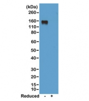 Western blot of nonreduced(-) and reduced(+) mouse IgG2a, using 0.5ug/ml of recombinant Mouse IgG2a antibody. This mAb reacts to nonreduced IgG2a (~150 kDa).