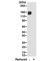 Western blot of nonreduced(-) and reduced(+) rabbit IgG (20ng/lane), using 0.2ug/ml of recombinant Rabbit IgG Fab antibody. This antibody reacts to nonreduced rabbit IgG (~150 kDa).
