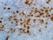 IHC testing of FFPE human tonsil tissue with recombinant Human Kappa Light Chain antibody. A pH6 Citrate buffer or pH9 Tris/EDTA buffer HIER step is recommended for testing of FFPE tissue sections.