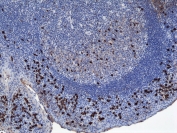 IHC testing of FFPE human tonsil tissue with recombinant Human IgA1 antibody. A pH6 Citrate buffer or pH9 Tris/EDTA buffer HIER step is recommended for testing of FFPE tissue sections.