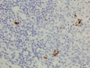 IHC testing of FFPE human lymphoid tissue with recombinant Human IgG3 antibody. A pH6 Citrate buffer or pH9 Tris/EDTA buffer HIER step is recommended for testing of FFPE tissue sections.