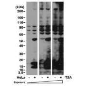 Western blot of human HeLa cells non-treated or treated with Trichostatin A (TSA) with recombinant Acetyl Lysine antibody at 1:2000.