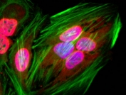 ICC staining of human HeLa cells using recombinant Acetyl Lysine antibody (red). Actin filaments was labeled with fluorescein phalloidin (green), and nuclei stained with DAPI (blue).