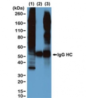 IP of Calyculin A/Okadaic Acid treated human A431 cells by the recombinant Phosphothreonine antibody at 1:500, and then blotted with same mAb at 1:2000. (1) Whole lysate control; (2) IP by rabbit IgG control; (3) IP by RM102.