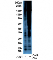 Western blot of serum-starved human A431 cells non-treated or treated with Calyculin A/Okadaic Acid, using the recombinant Phosphothreonine antibody at 1:2000.