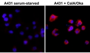 ICC of serum-starved human A431 cells non-treated or treated with Calyculin A/Okadaic Acid, using the recombinant Phosphothreonine antibody at 1:500 (PE-secondary, red) and DAPI (blue).