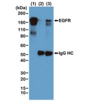 IP of EGF-treated human A431 cells by the recombinant Phosphotyrosine antibody at 1:1000 and blotted with an anti-EGFR mAb. (1) Whole lysate control; (2) IP by rabbit IgG control; (3) IP by RM111 mAb.