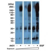 Western blot of serum-starved human A431 cells non-treated or treated with EGF using the recombinant Phosphotyrosine antibody at 1:5000. The blot was exposed to the film at different time points.