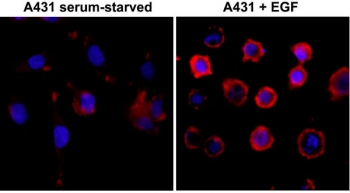 ICC test of serum-starved human A431 cells non-treated or treated with EGF, using the recombinant Phosphotyrosine antibody at 1:500 (red) and DAPI (blue).