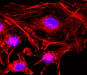 ICC staining of human HeLa cells using the recombinant Beta Actin antibody at 1:200 (red) and DAPI to stain the nuclei (blue).