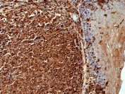 IHC staining of FFPE human tonsil with recombinant Beta Actin antibody at 1:1000 (clone RM112). HIER: boil tissue sections in pH 6 citrate buffer or pH 9 10mM Tris with 1mM EDTA for 20 min and allow to cool before testing.