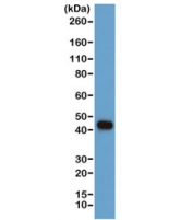 Western blot of human A431 cells using the recombinant Beta Actin antibody at a 1:1000. Predicted molecular weight ~42 kDa.