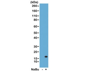 Western Blot of acid extracts from human HeLa cells untreated (-) or treated (+) with sodium butyrate using the recombinant H3K14ac antibody at 0.5 ug/ml.