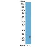 Western Blot of acid extracts from human HeLa cells untreated (-) or treated (+) with sodium butyrate using the recombinant H3K14ac antibody at 0.5 ug/ml.
