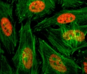 ICC testing of human HeLa cells treated with sodium butyrate using recombinant H3K4me1 antibody (red). Actin filaments have been labeled with fluorescein phalloidin (green).
