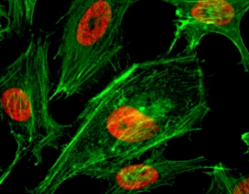 ICC testing of human HeLa cells treated with sodium butyrate using recombinant H3K4me2 antibody (red). Actin filaments have been labeled with fluorescein phalloidin (green).