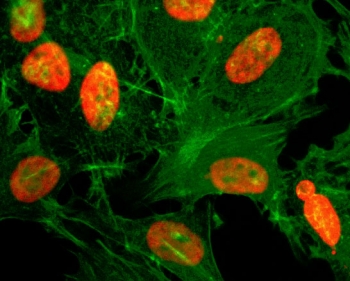 ICC testing of HeLa cells treated with sodium butyrate using the recombinant H3K36ac antibody (red). Actin filaments have been labeled with fluorescein phalloidin (green).
