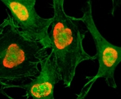 ICC testing of HeLa cells treated with sodium butyrate using recombinant H3K79ac antibody (red). Actin filaments have been labeled with fluorescein phalloidin (green).