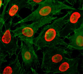 ICC/IF testing of HeLa cells treated with sodium butyrate using recombinant H3K9ac antibody (red). Actin filaments have been labeled with fluorescein phalloidin (green).