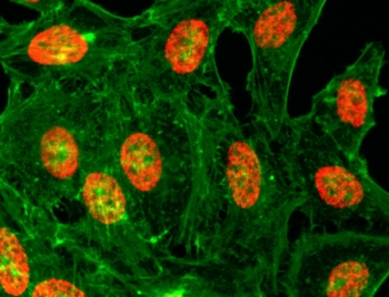 ICC/IF test of HeLa cells treated with sodium butyrate using recombinant H3K18ac antibody (red). Actin filaments have been labeled with fluorescein phalloidin (green).