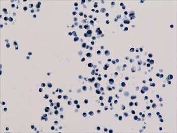 ICC staining of human HepG2 cells using recombinant H3K18ac antibody.
