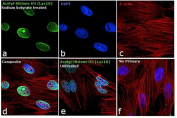Acetyl-Histone H3 (Lys18) Antibody sodium butyrate-treated HeLa cells IF. Immunofluorescence analysis of acetylated Histone H3 (Lys18) in human HeLa cells using Acetyl-Histone H3 (Lys18) monoclonal antibody RM166. The acetyl-Histone H3 (Lys18) antibody signal (green) shows strong nuclear localization in sodium butyrate-treated cells, consistent with increased histone acetylation. F-actin is visualized in red, and nuclei are counterstained with DAPI (blue). Untreated cells show reduced nuclear signal compared to treated cells, confirming acetylation-dependent staining. No primary antibody control shows absence of green signal, indicating specificity of staining.