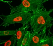 ICC/IF test of HeLa cells treated with sodium butyrate using recombinant H3K27ac antibody (red). Actin filaments have been labeled with fluorescein phalloidin (green).