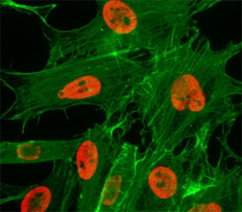 ICC/IF test of HeLa cells treated with sodium butyrate using recombinant H3K27ac antibody (red). Actin filaments have been labeled with fluorescein phalloidin (green).