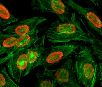 ICC/IF test of HeLa cells treated with sodium butyrate using recombinant H3K9me2 antibody (red). Actin filaments have been labeled with fluorescein phalloidin (green).