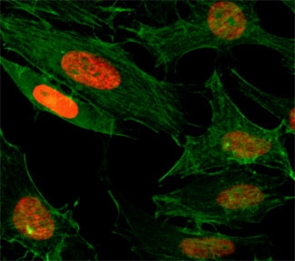 ICC/IF test of HeLa cells treated with sodium butyrate using recombinant H3K4ac antibody (red). Actin filaments have been labeled with fluorescein phalloidin (green).