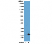 Western blot of acid extracts from HeLa cells untreated (-) or treated (+) with sodium butyrate using recombinant H3K4ac antibody at 0.5 ug/ml showed a band of Histone H3 acetylated at Lysine 4 in treated HeLa cells.