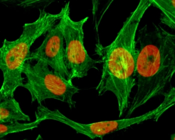 ICC/IF testing of human HeLa cells treated with sodium butyrate using recombinant H3K9me1 antibody (red). Actin filaments have been labeled with fluorescein phalloidin (green).