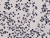 ICC testing of human HepG2 cells with recombinant H3K27me3 antibody.